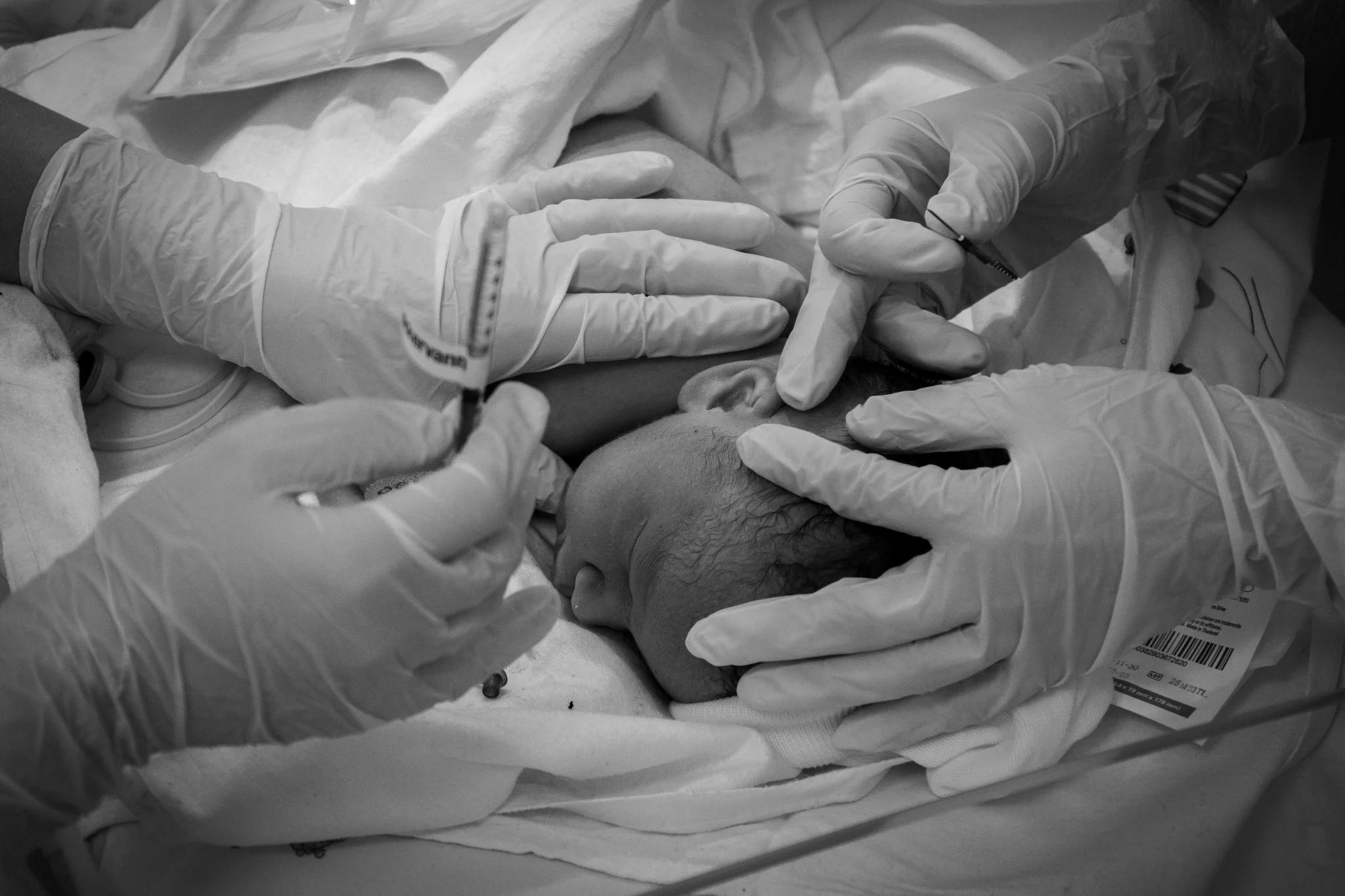 Medical team inserting a syringe into a newborn head during an injection procedure, with gloves and medical attire.
