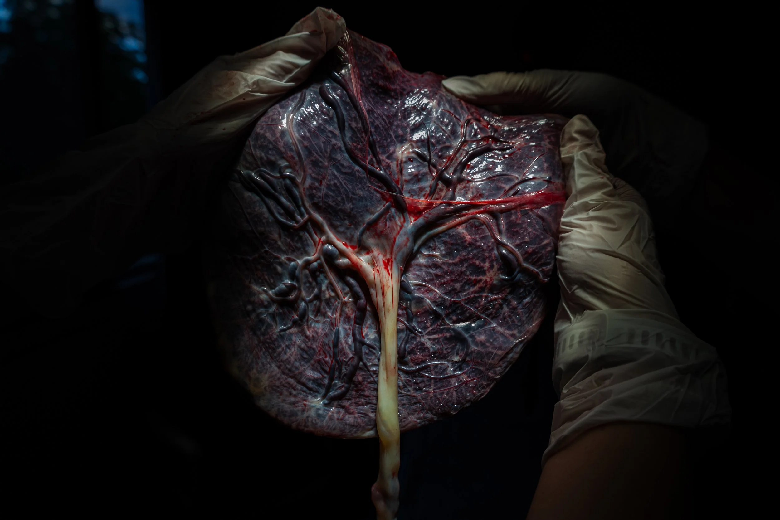 Close-up view of biological tissue/placenta with dark and red areas, depicting internal organs after birth