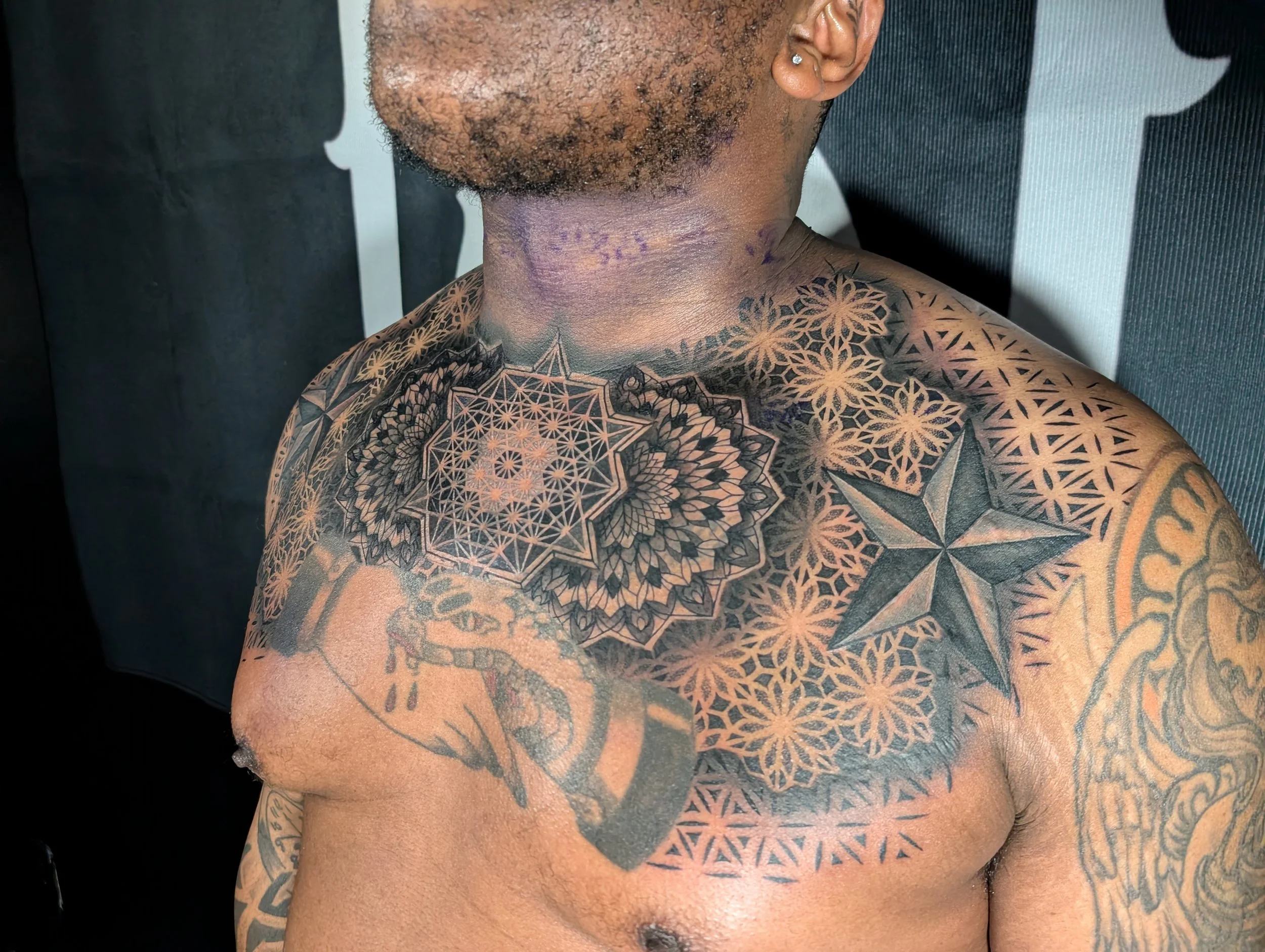 A person's upper chest and neck with intricate geometric tattoo designs, purple markings, and skin irritation.