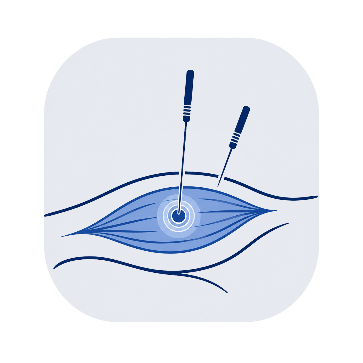 Illustration of a microcurrent facial device with electrodes stimulating a facial muscle beneath the skin, with wave-like lines indicating energy or movement.