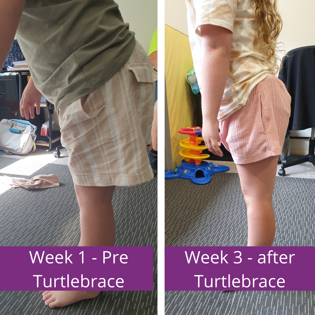 JumpStartPhysio_Blog_05.png