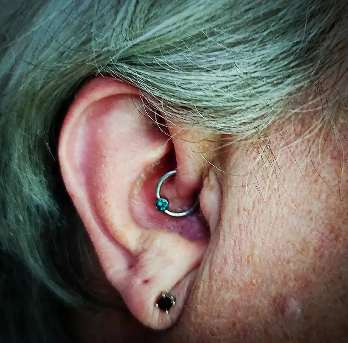 Tragus