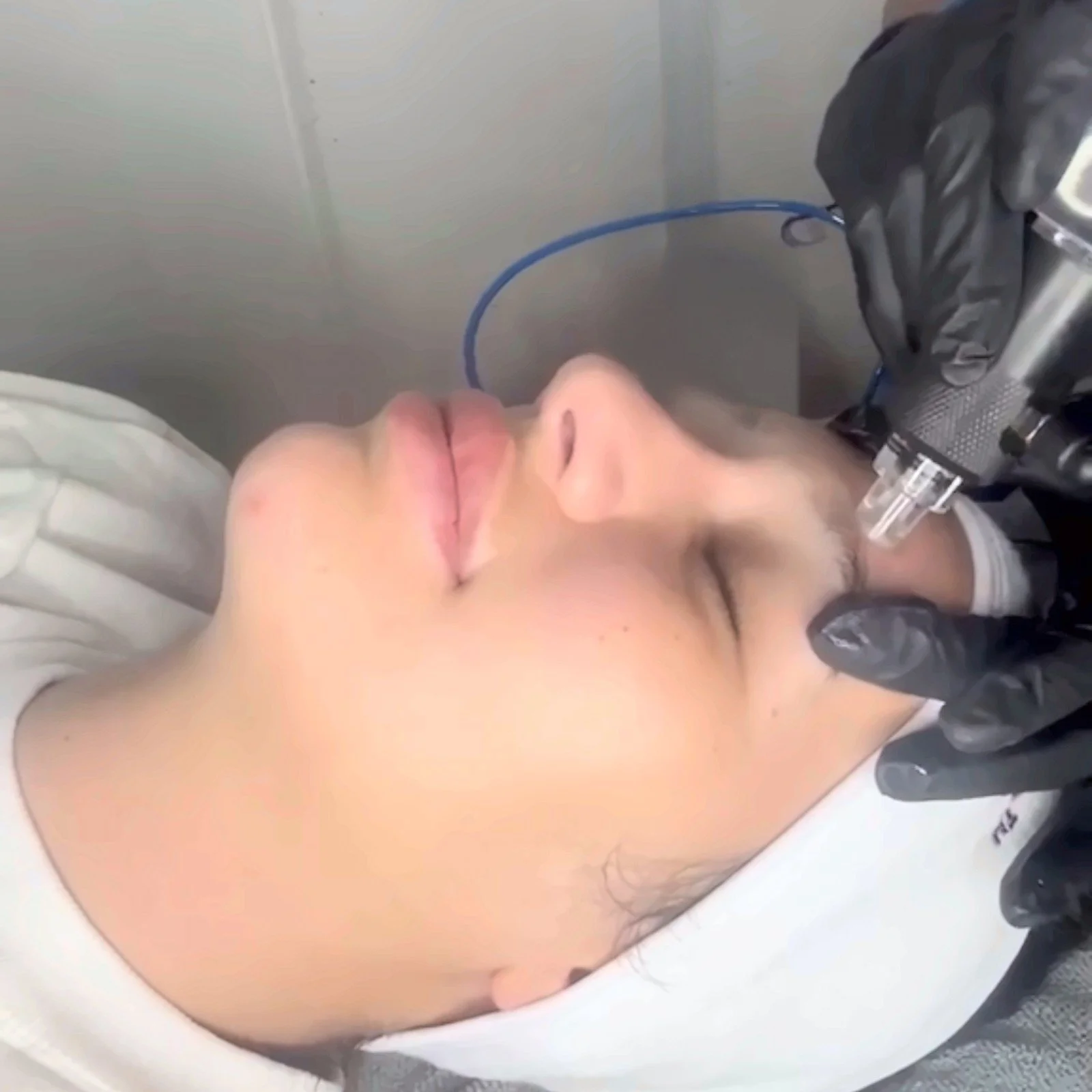 Signature Hydro Facial