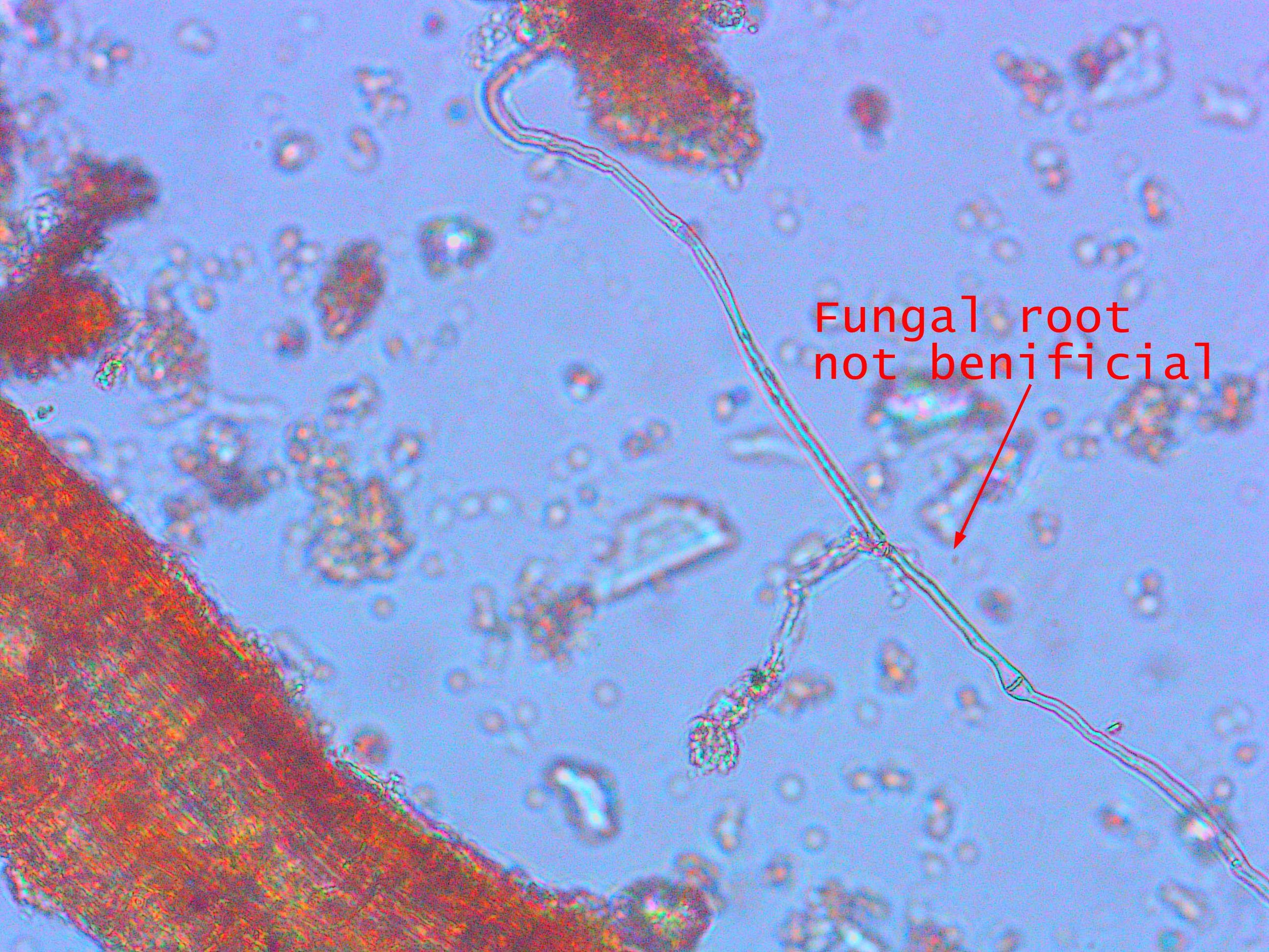 Micrograph of a fungal root, not beneficial, with a long root filament extending from it. The background shows numerous small particles and structures. The image has text indicating the root is not beneficial.