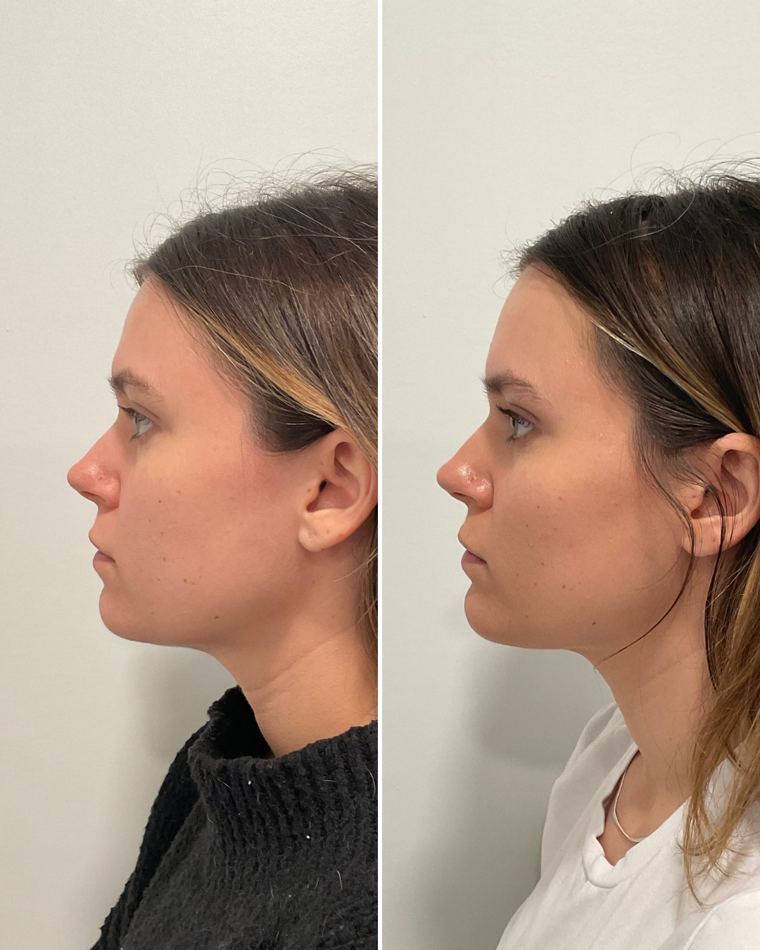 FACIAL BALANCING