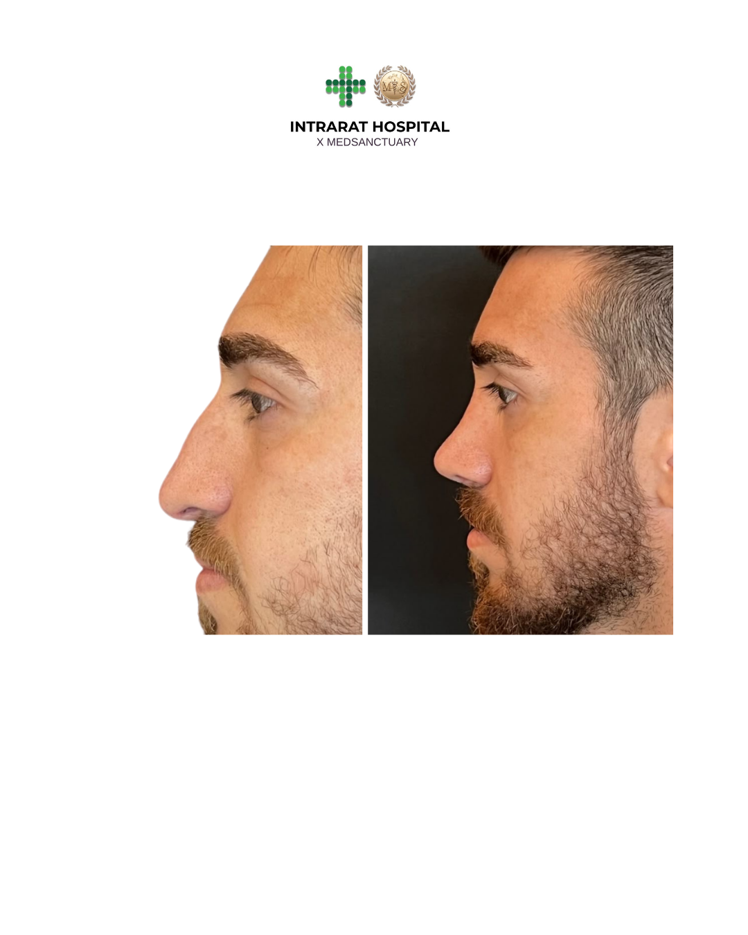 before after - 51.png
