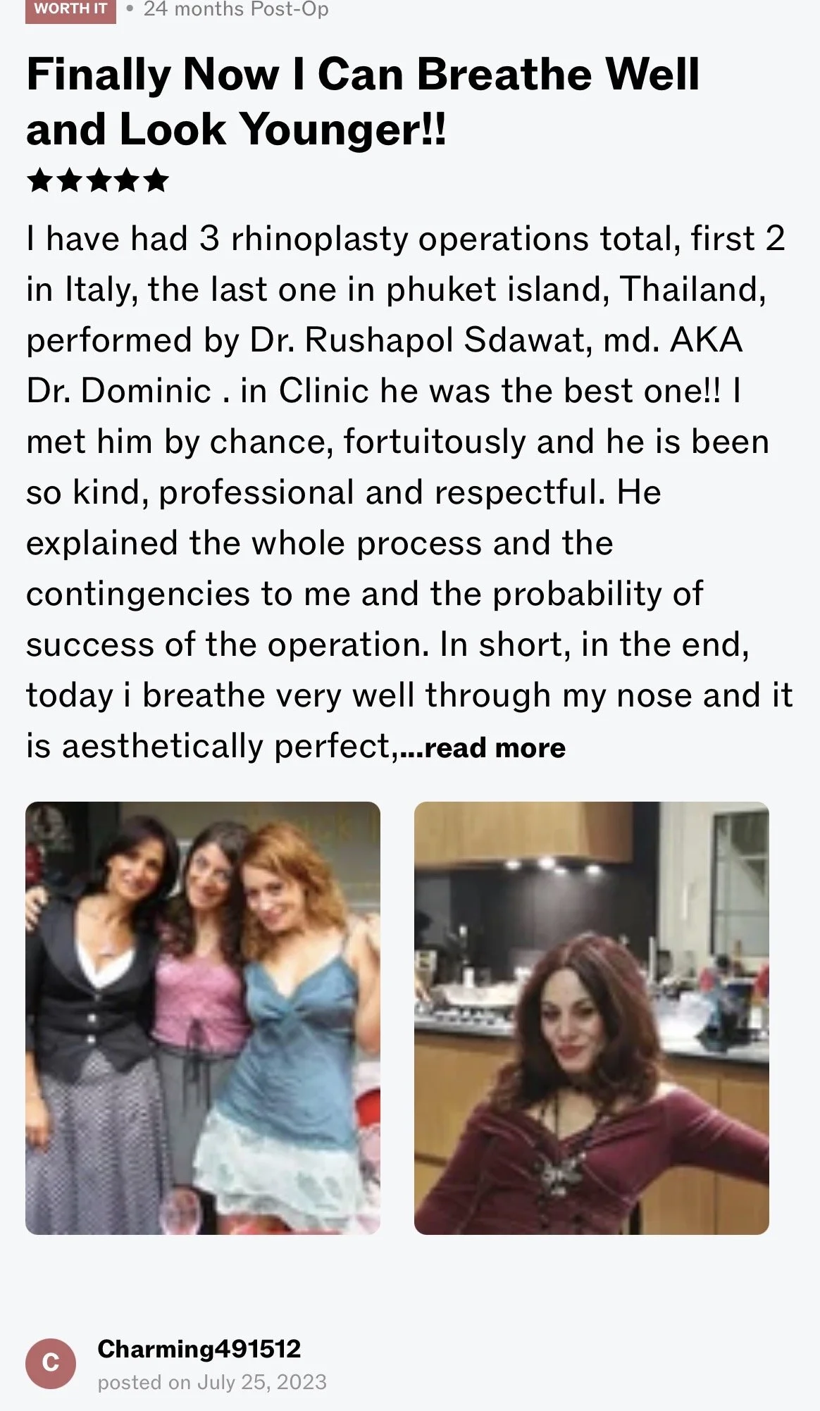 A screenshot of a social media post with a title indicating success in breathing and looking younger after three rhinoplasty surgeries. The post includes two photos: the left photo shows three women smiling and posing together indoors, and the right photo shows a woman with long, curly hair sitting in a kitchen.