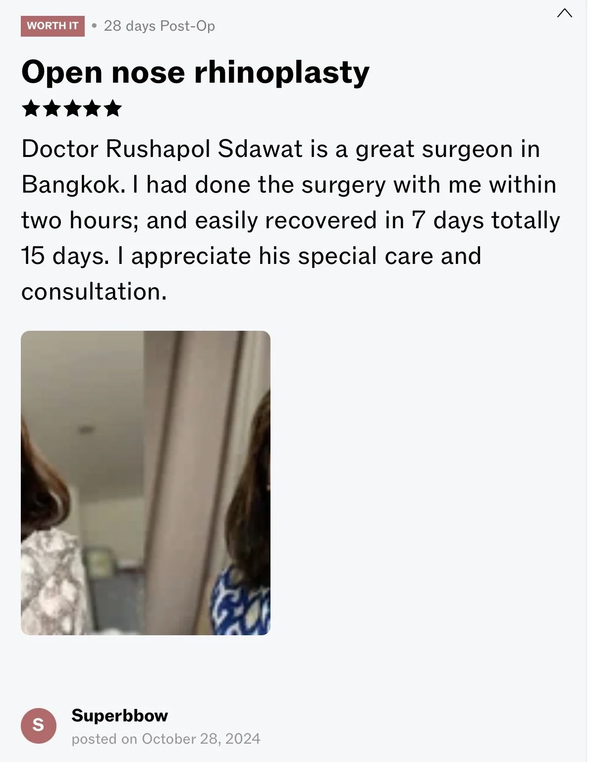Review of open nose rhinoplasty by Doctor Rushapol Sawat, with a five-star rating, mentioning quick recovery and high satisfaction.