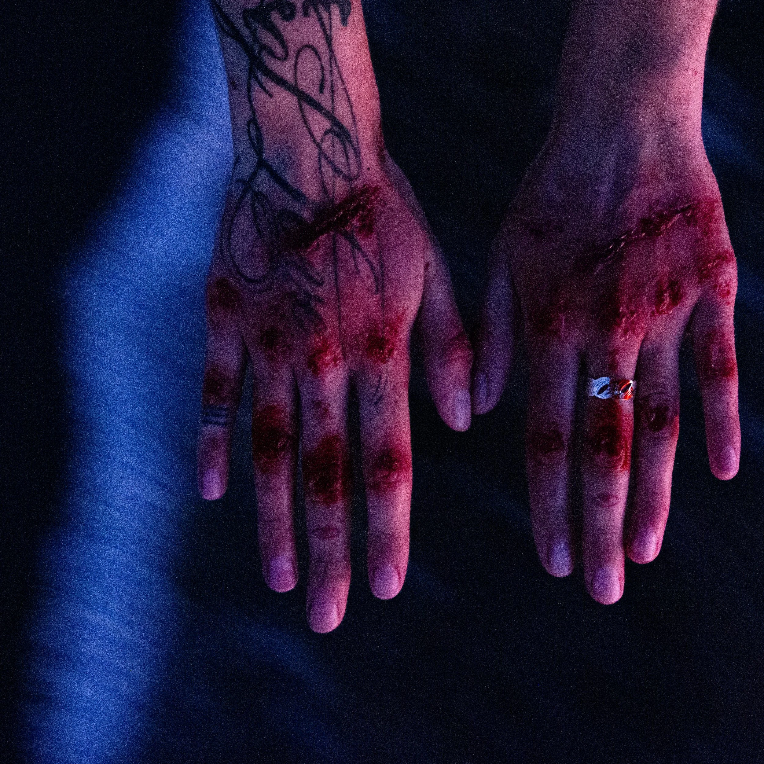 injury sfx