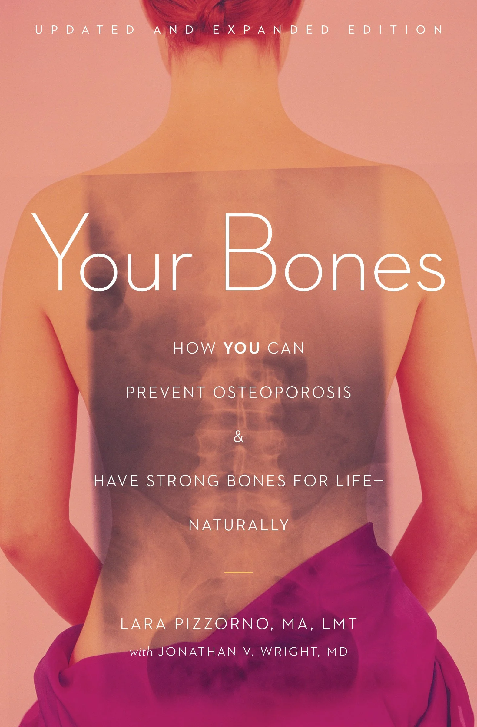 Your Bones: How You Can Prevent Osteoporosis & Have Strong Bones For Life - Naturally
