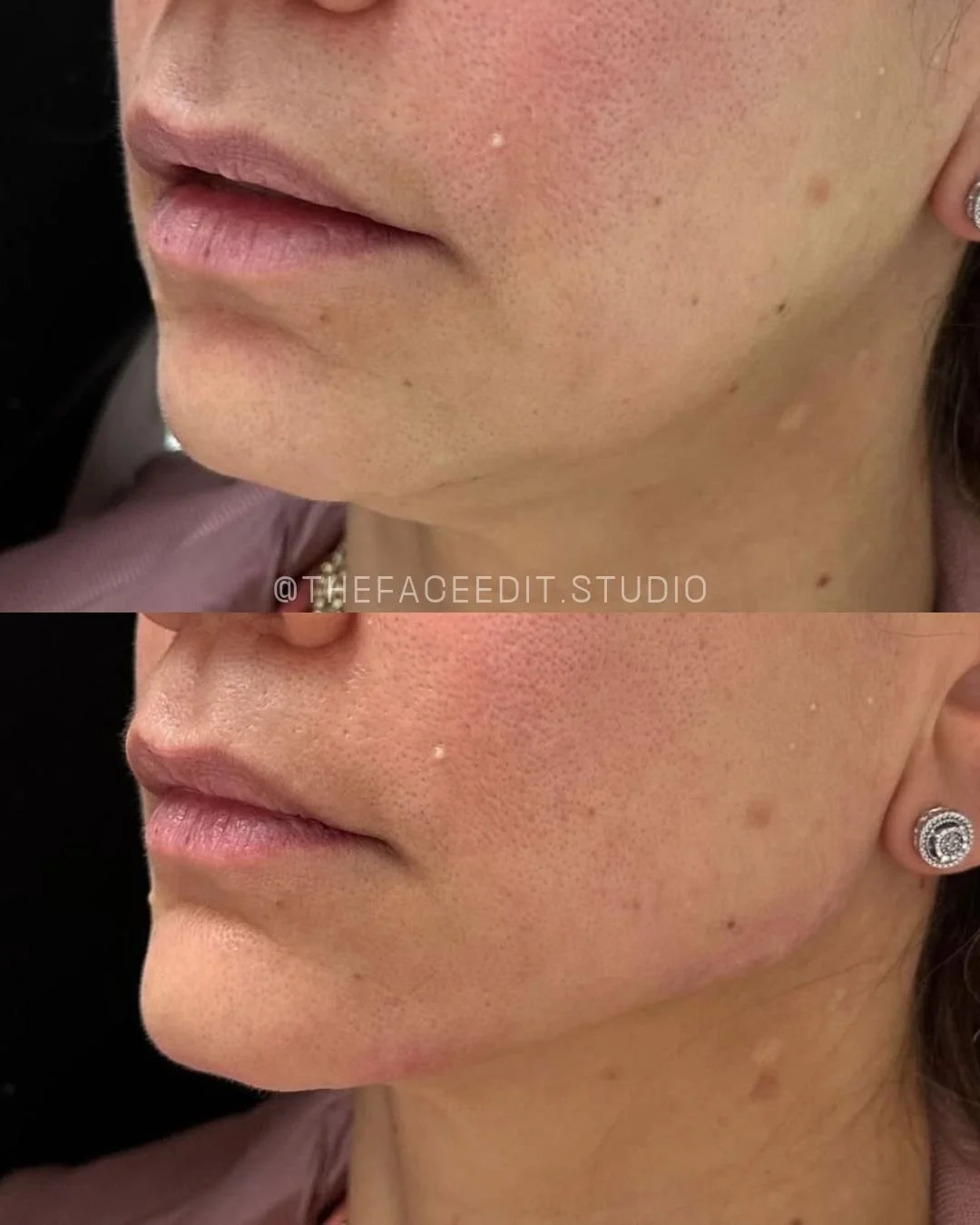 Copy of Copy of Copy of Before and Afters (Portrait Size) 2.jpeg
