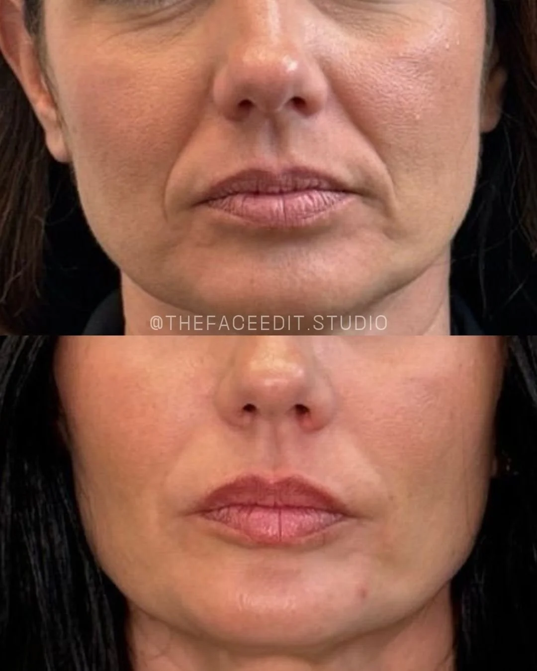 Copy of Copy of Copy of Before and Afters (Portrait Size).jpeg