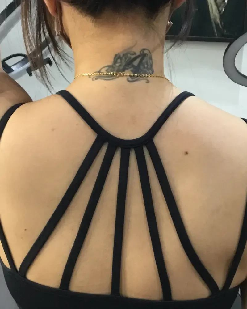 0359 - cover up neck flower before.webp