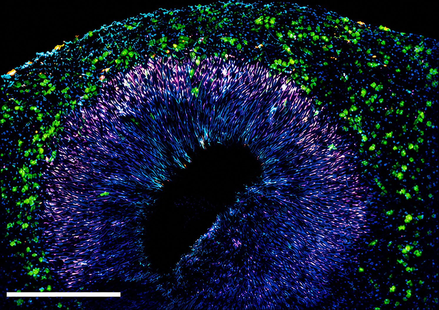 Image of a Neural rosette