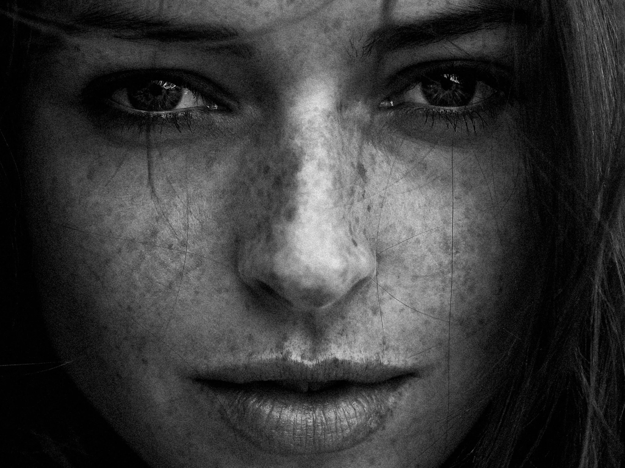 Close-up of a person's face full of freckles, showing only the eyes, nose, and mouth in black and white.