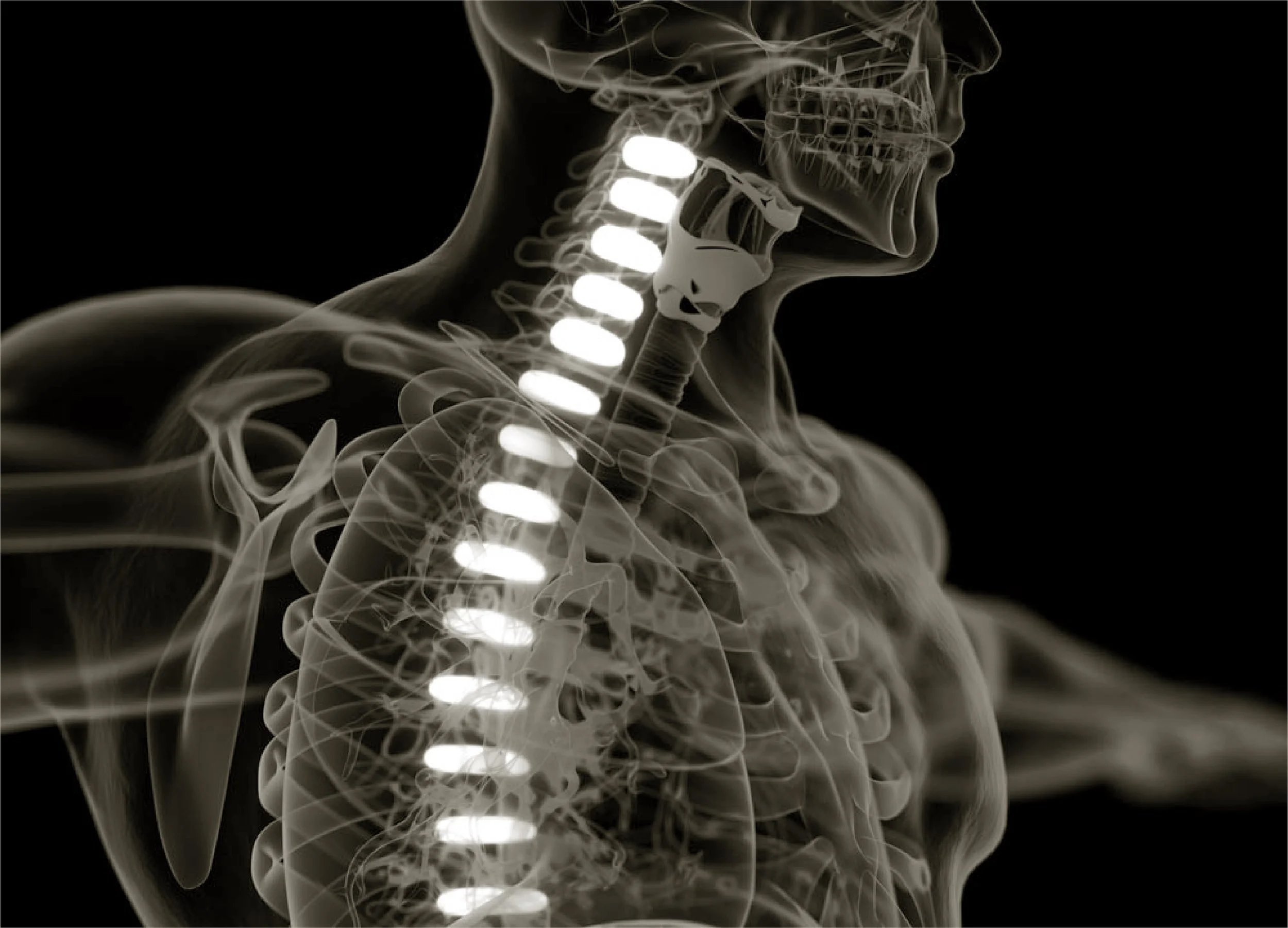 Henderson Chiropractic xray spine