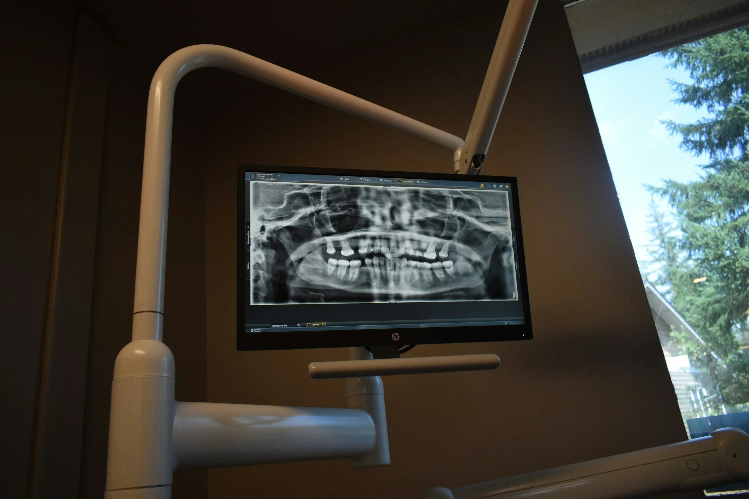 Medical monitor displaying a dental X-ray image, with a window showing trees and blue sky outside.