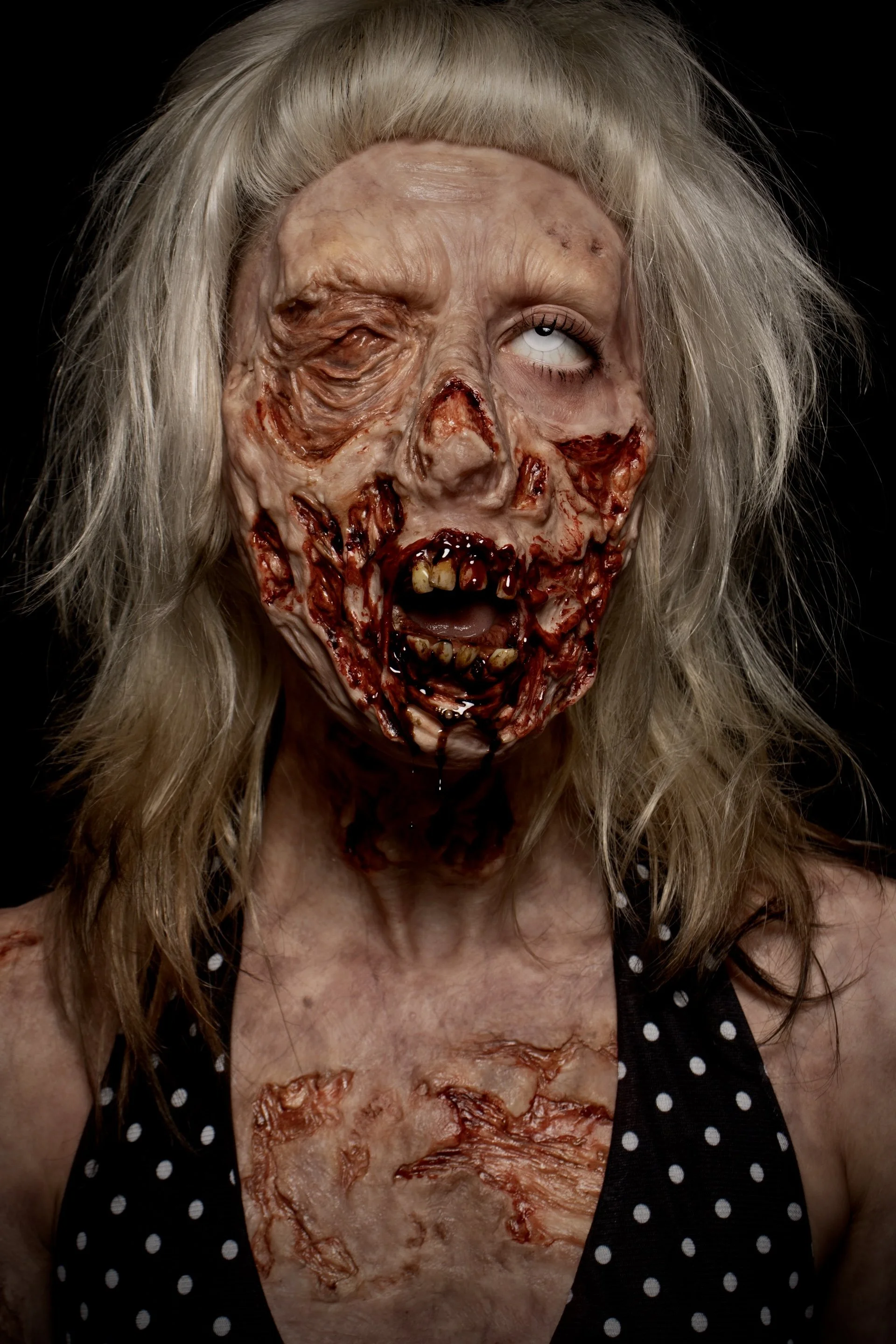 Prosthetics