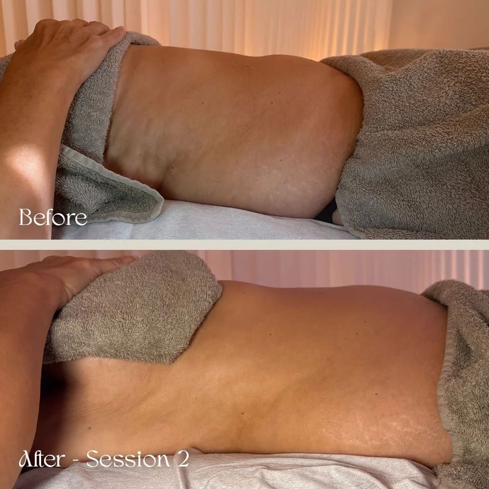 Comparison of a person's lower back before and after a massage therapy session, showing reduced muscle tension and improved skin appearance.