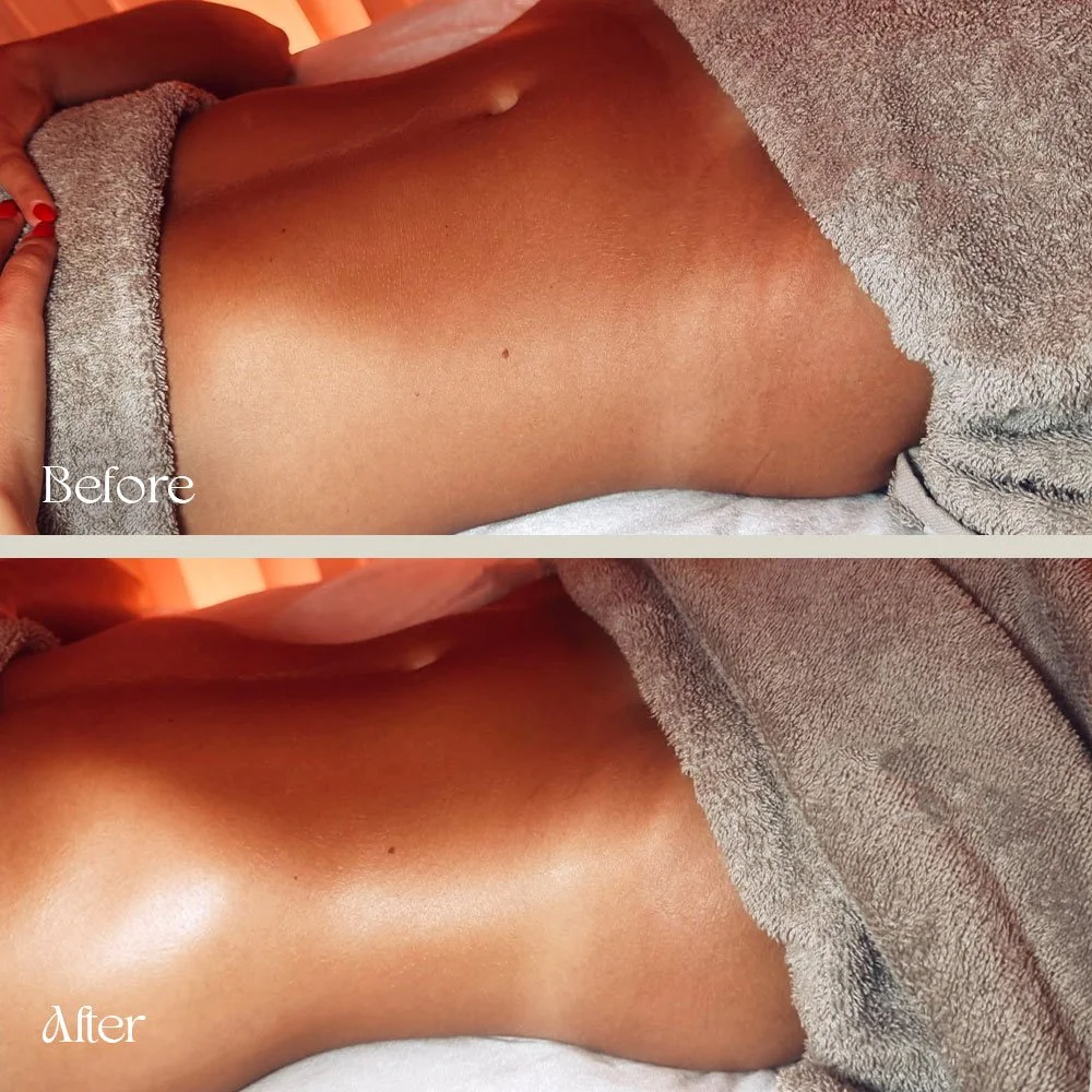 A comparison shot showing the side of a person's leg before and after a skincare treatment, with smoother and shinier skin in the 'after' image.