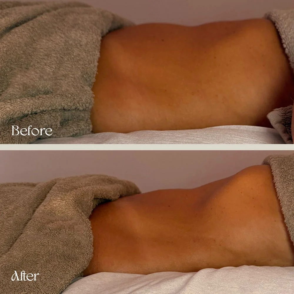 Comparison of a person's back before and after a massage or treatment, showing smoother skin and less tension in the after image.