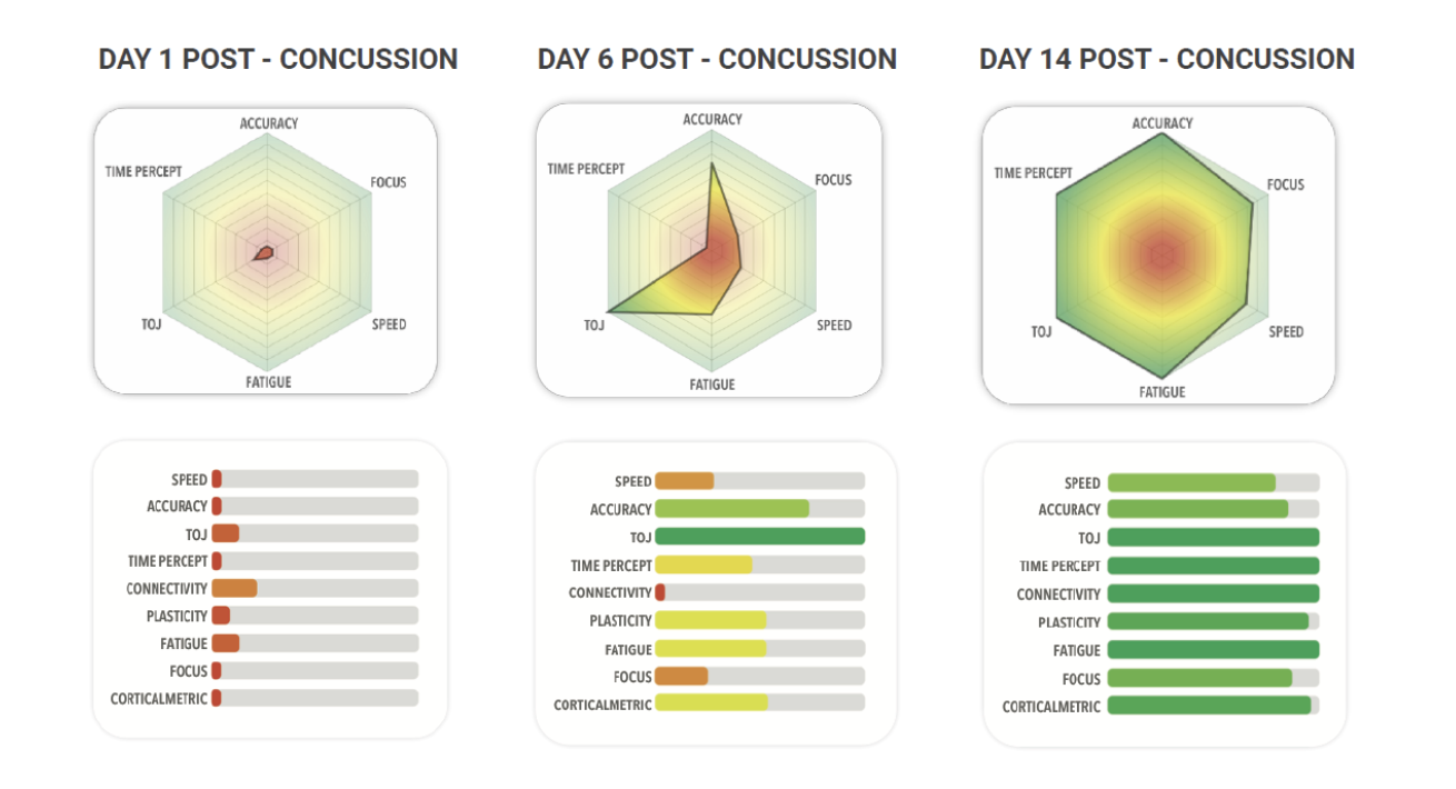 image of graphs and data of concussion information