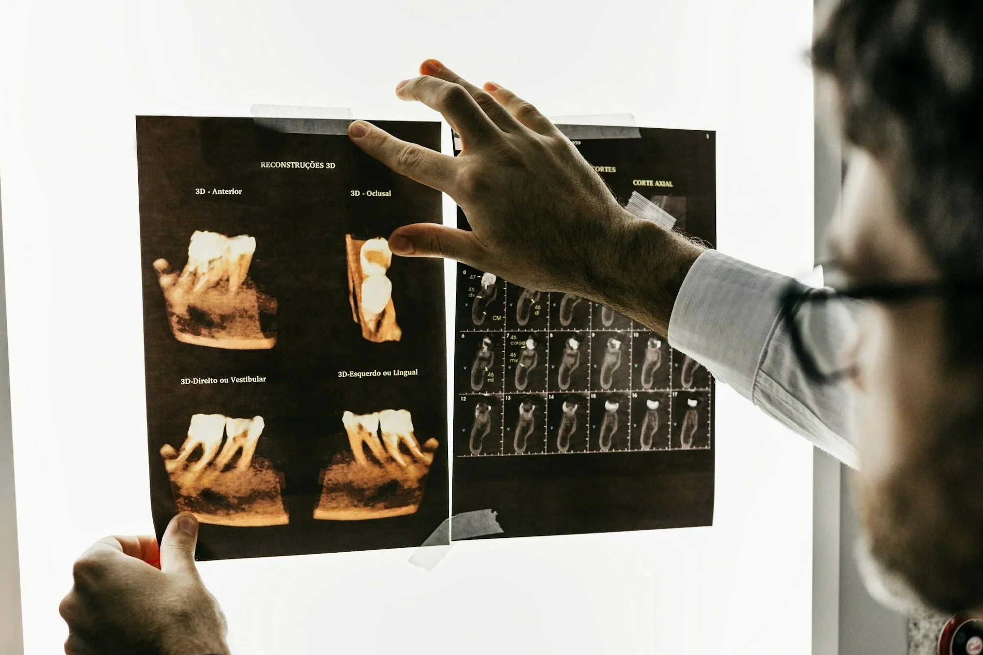 Person holding medical imaging scans of teeth and jaw, with X-ray images in the background, possibly in a medical or dental setting.
