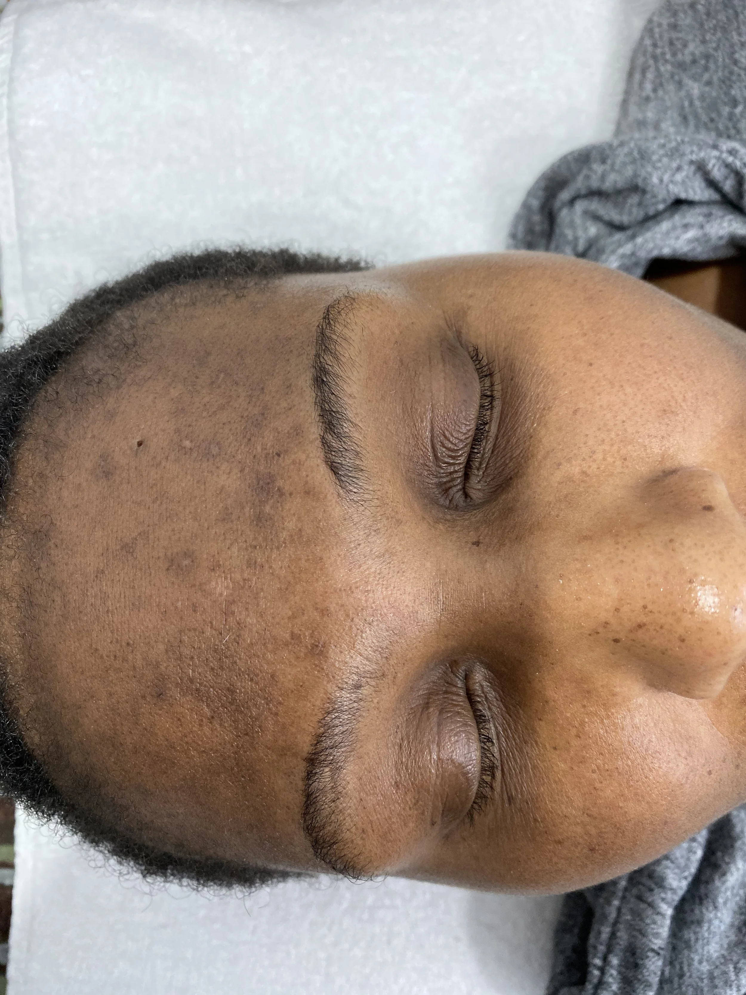 Close-up of a person's face with closed eyes, showing skin texture and facial features.