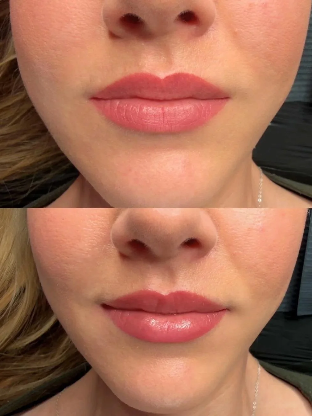 lipblush before and after