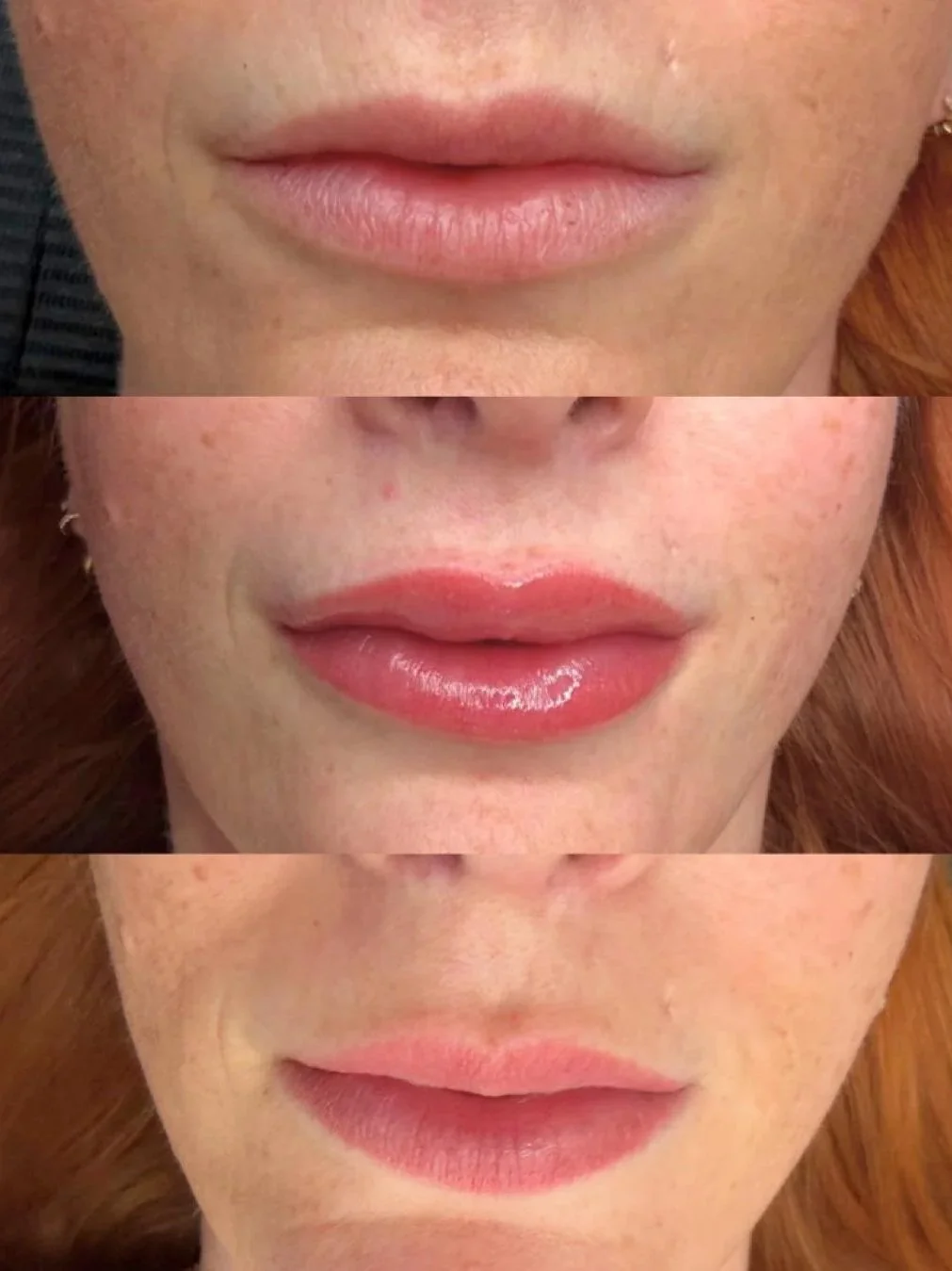 WhatsApp+Image+2026-08-14+at+17.05.24lipblush+before+to+healed.jpg