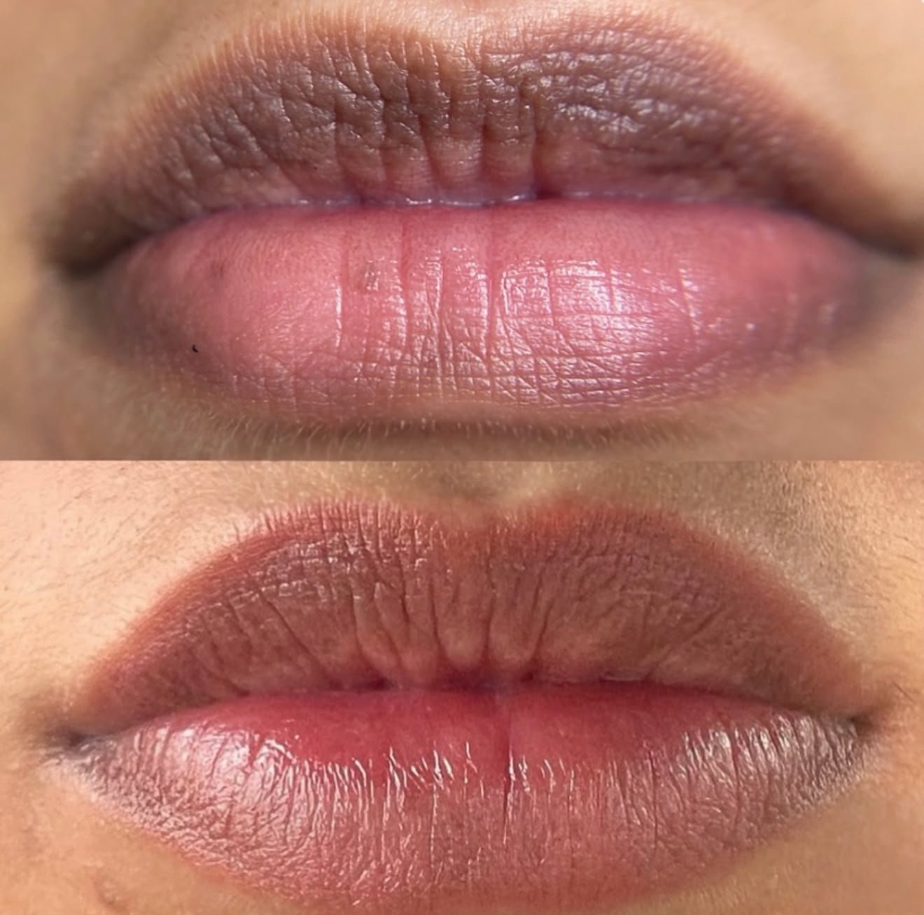 Dark Lip Neutralisation Treatment 