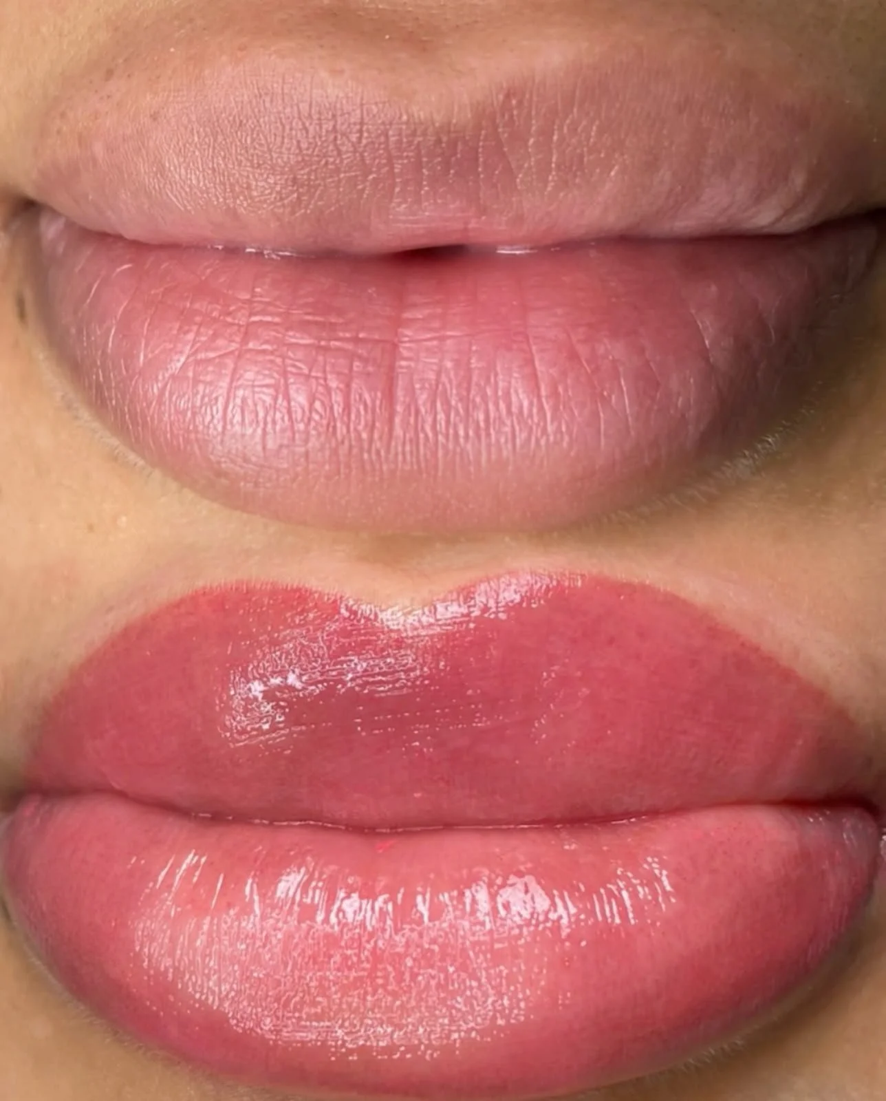 Dark Lip Neutralisation 