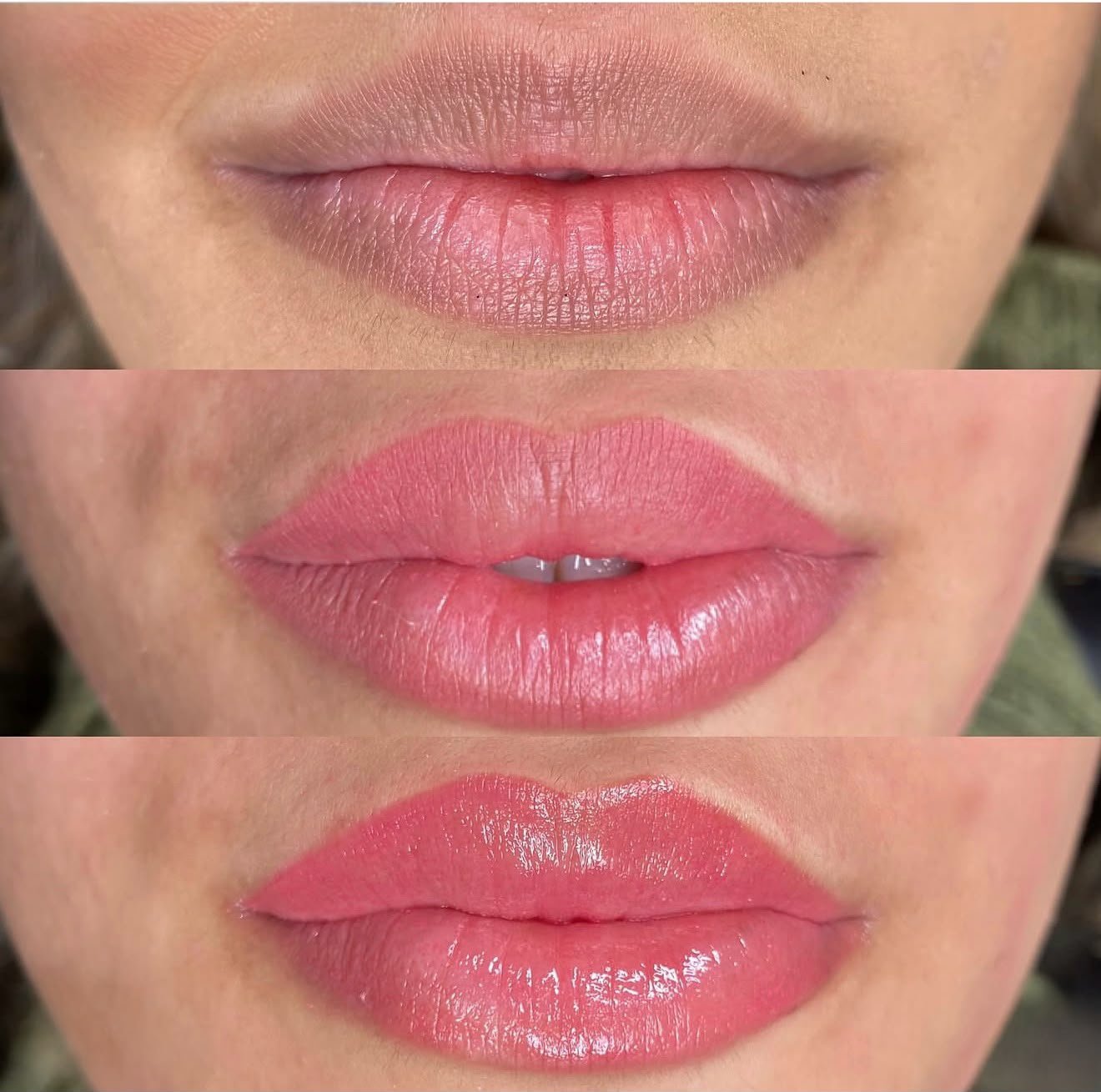 Dark Lip Neutralisation Treatment 