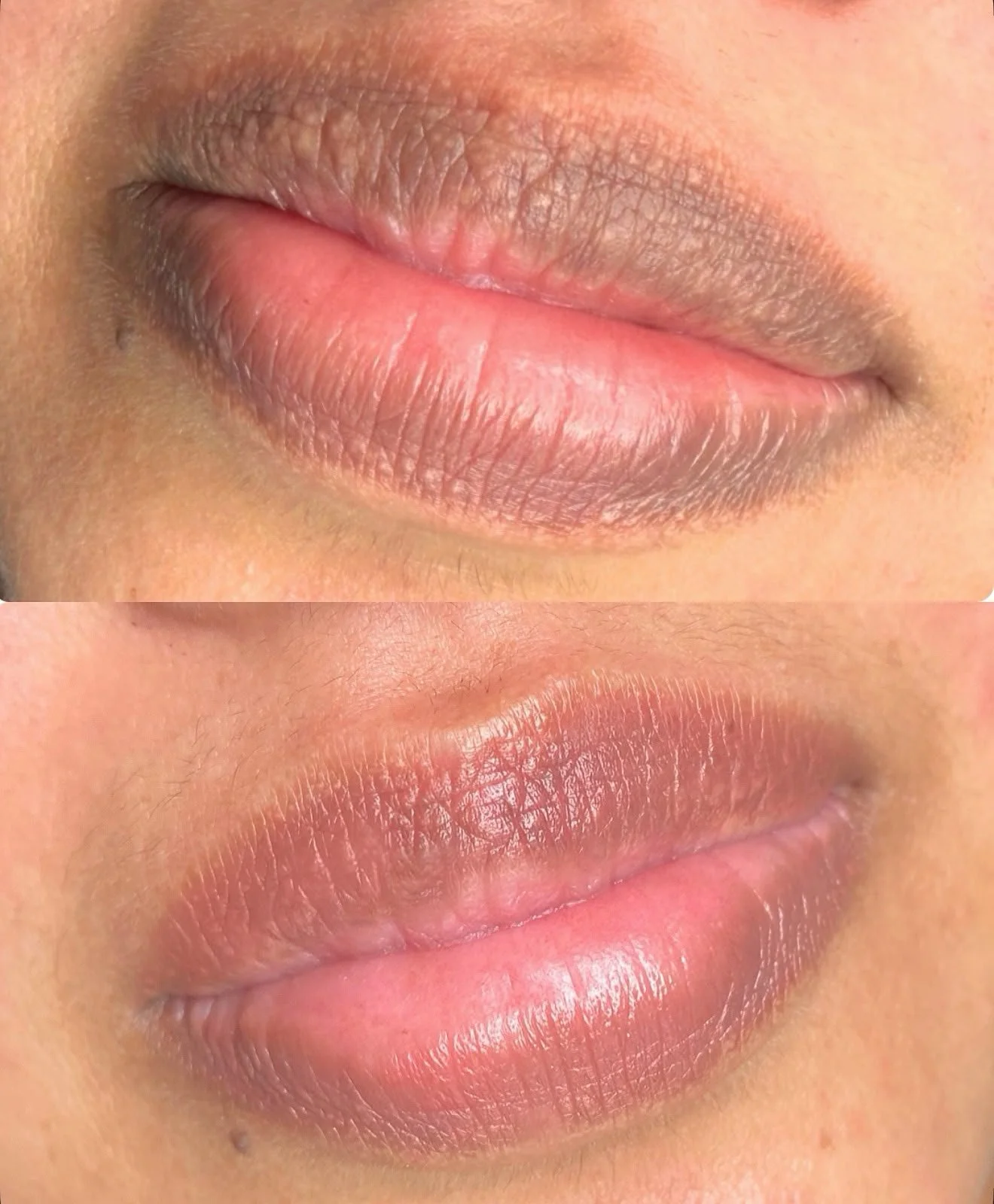 Dark Lip Neutralisation Treatment 