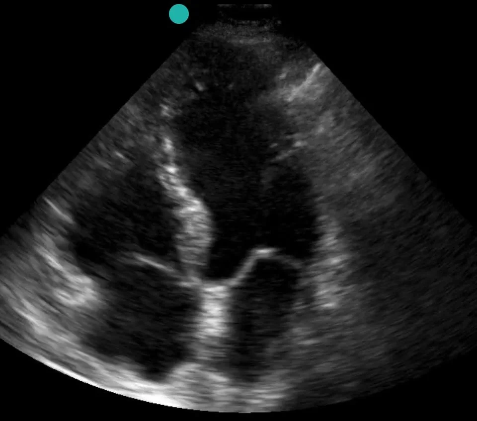 Focused Point-of-Care Ultrasound