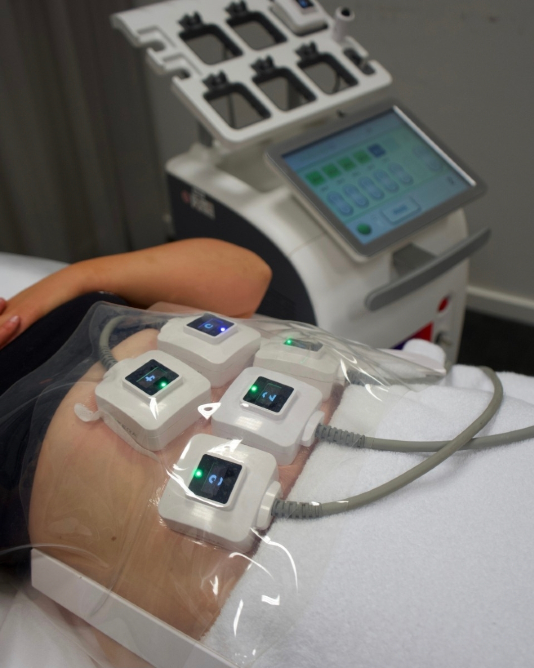 Tighten &amp; Tone: The Rise of Non-Surgical Skin Tightening Treatments