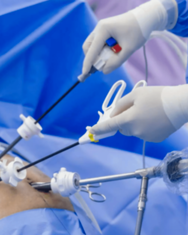 Close-up of a surgeon's hands in gloves performing laparoscopic surgery with specialized surgical instruments.