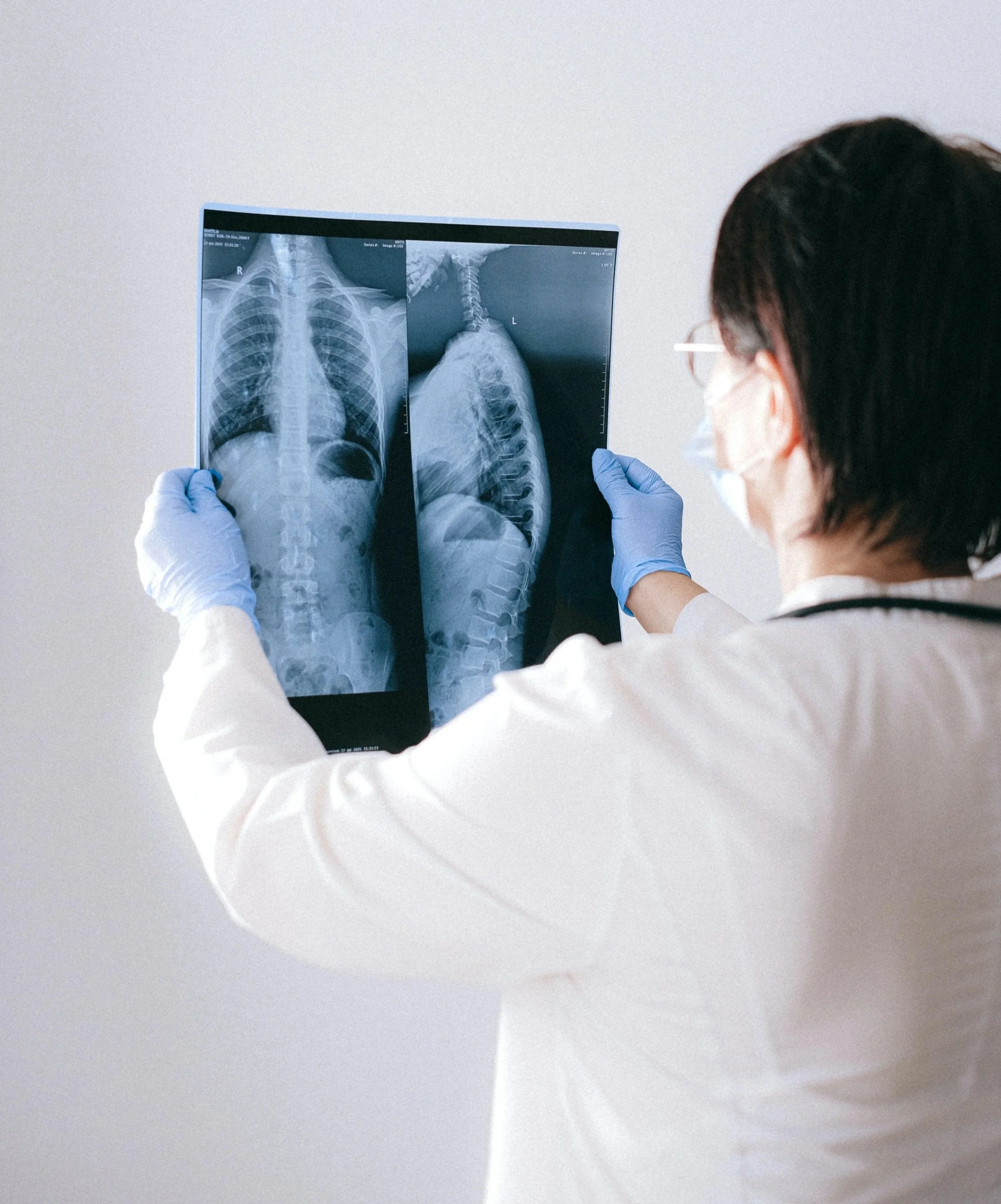 Healthcare professional wearing gloves and face mask examining two X-ray images of a person's chest and spine.
