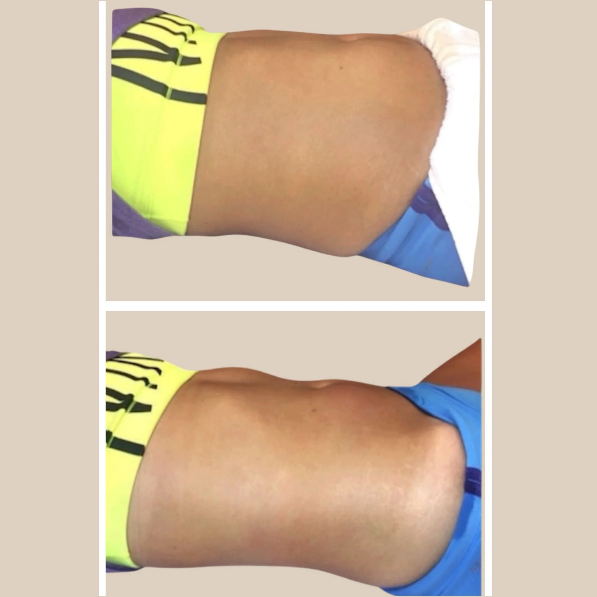 Signature manual lymphatic drainage massage immediate results at The Yoly Glow West Hollywood