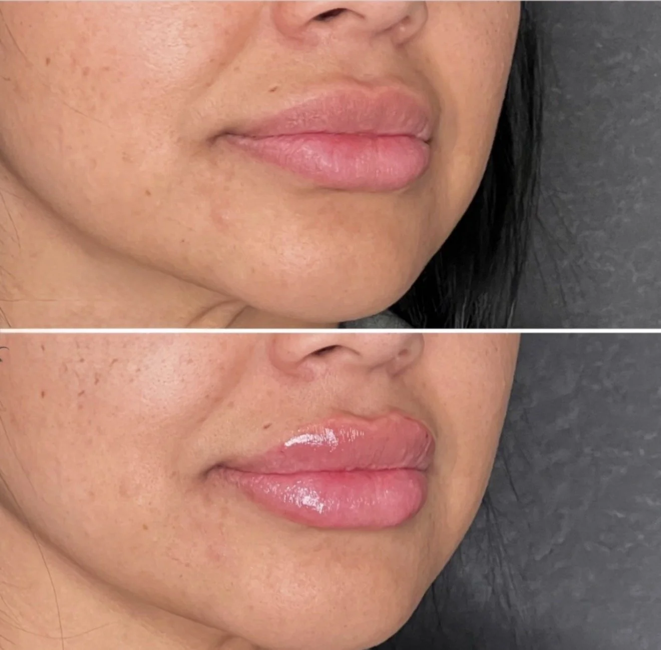 Comparison of a person's lips before and after applying clear lip gloss, with the lips appearing glossier and more prominent in the after image.