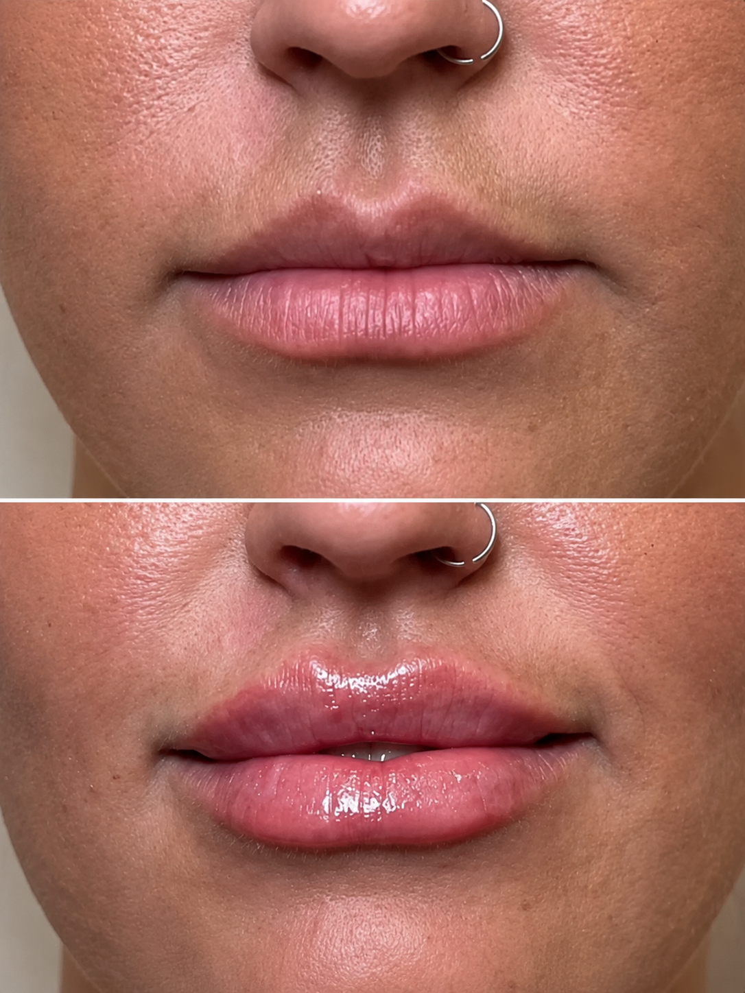 Close-up of a person's lips before and after applying lip gloss. The top shows natural lips, the bottom shows glossy lips.