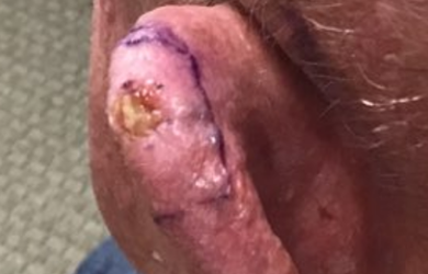 Simulation Ear Closeup