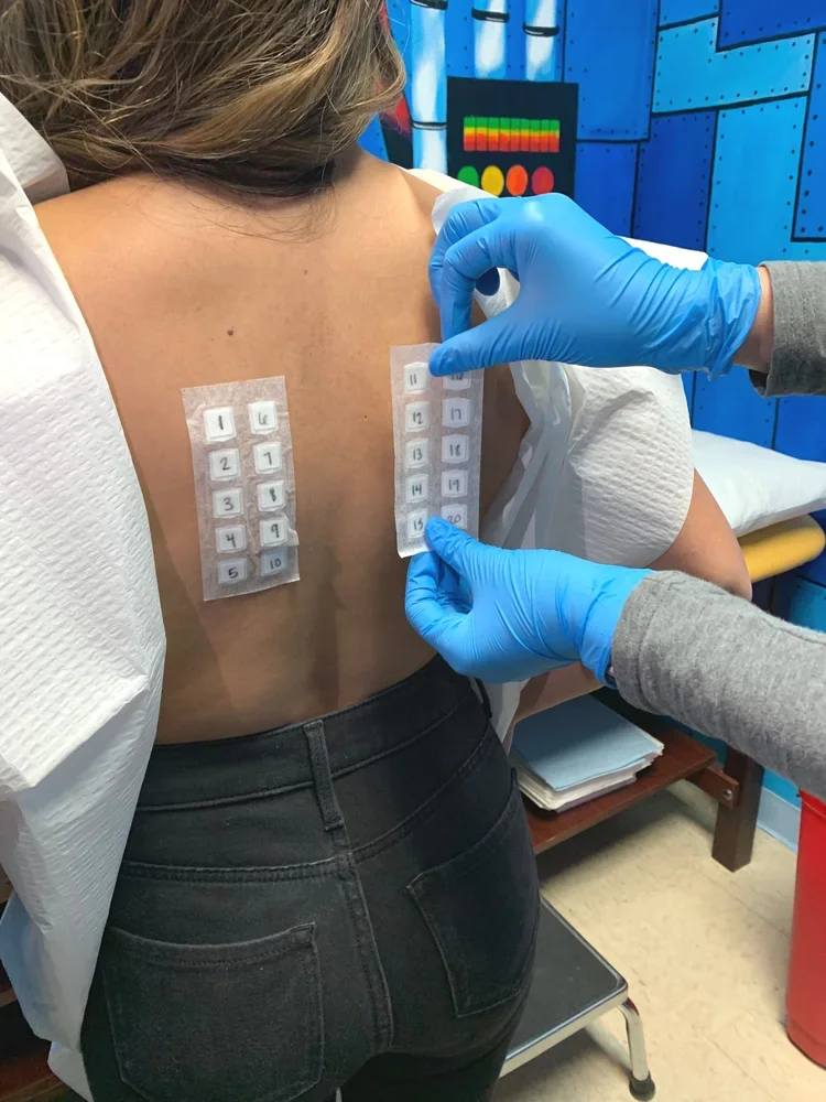 A person undergoing a medical test gets stickers with numbers applied to their back, with the help of a healthcare worker wearing blue gloves, in a clinical setting.