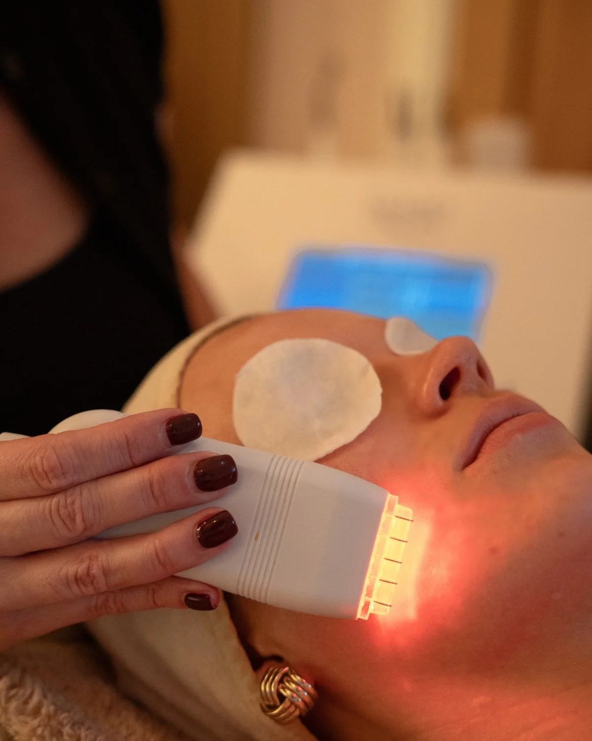 Advanced facial treatment at TG Skin and Wellness