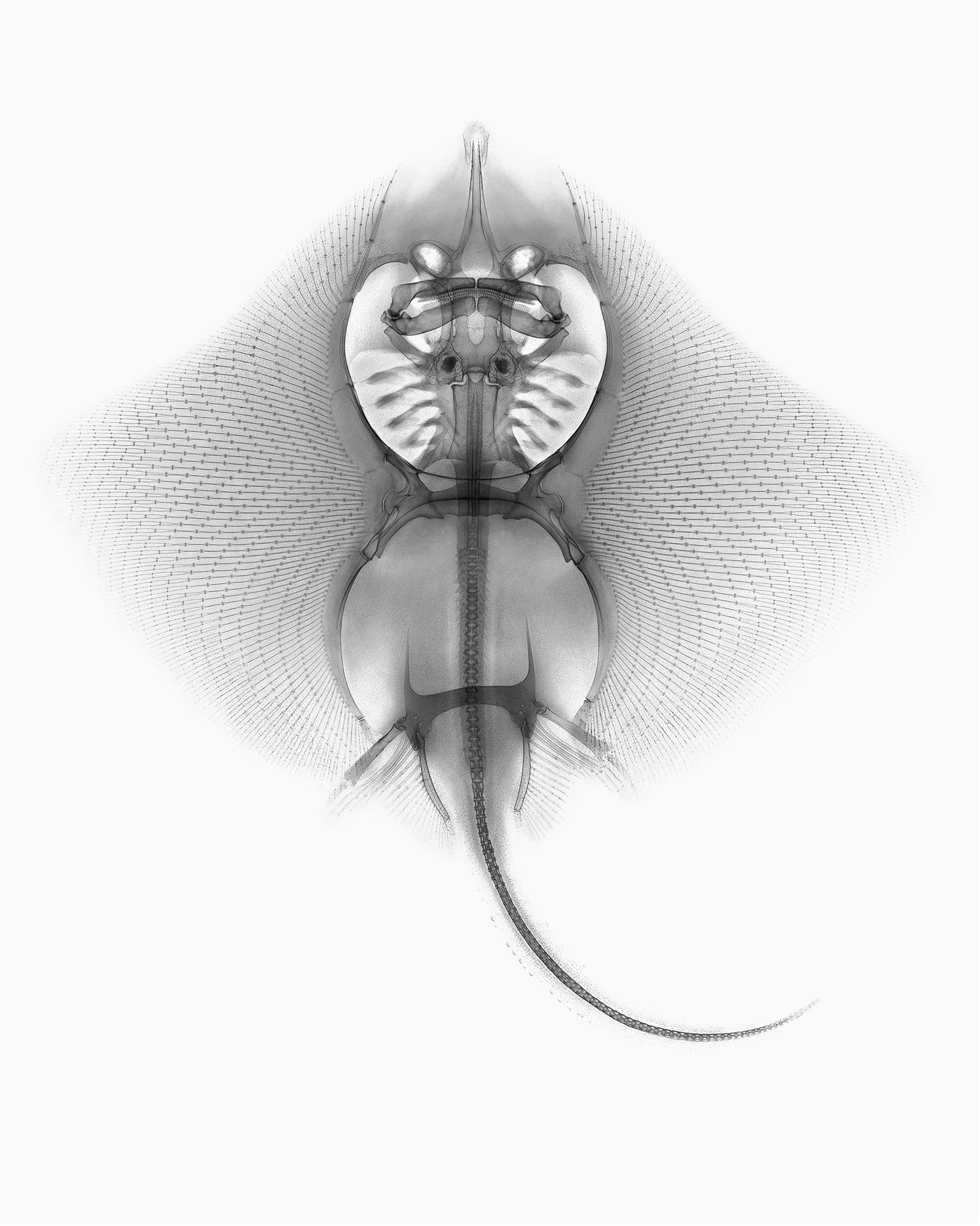 RAY