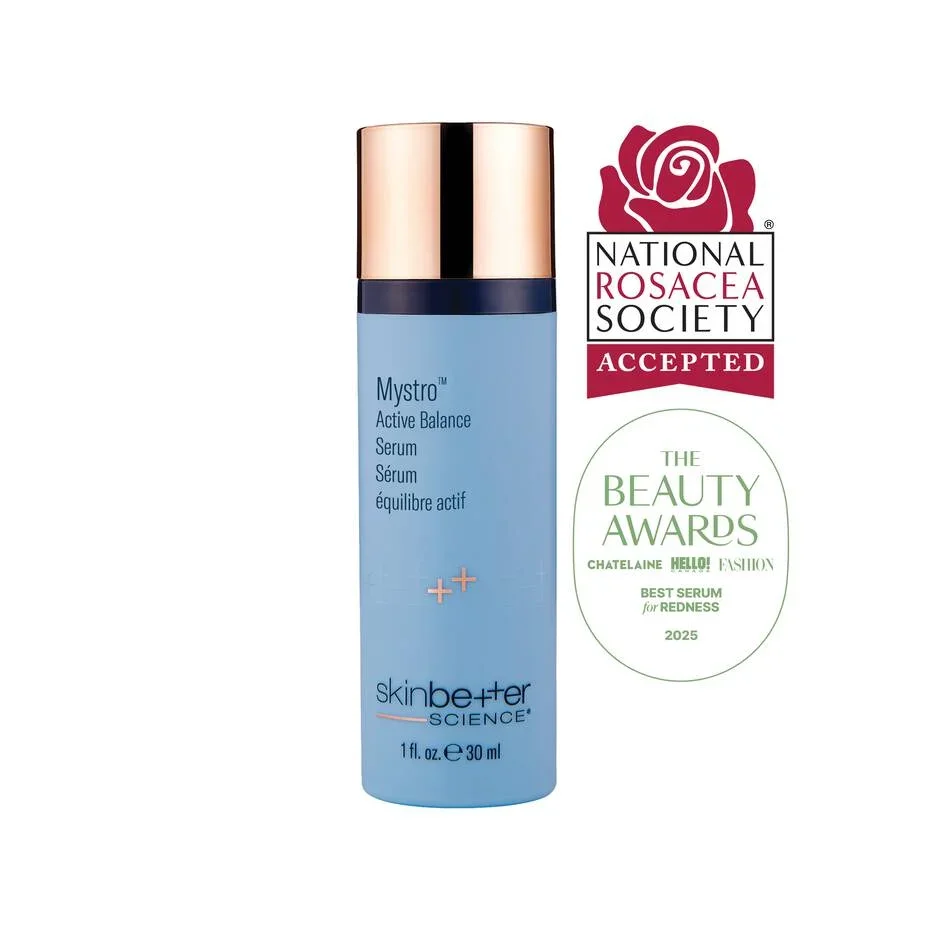 Mystro-Rosacea.webp