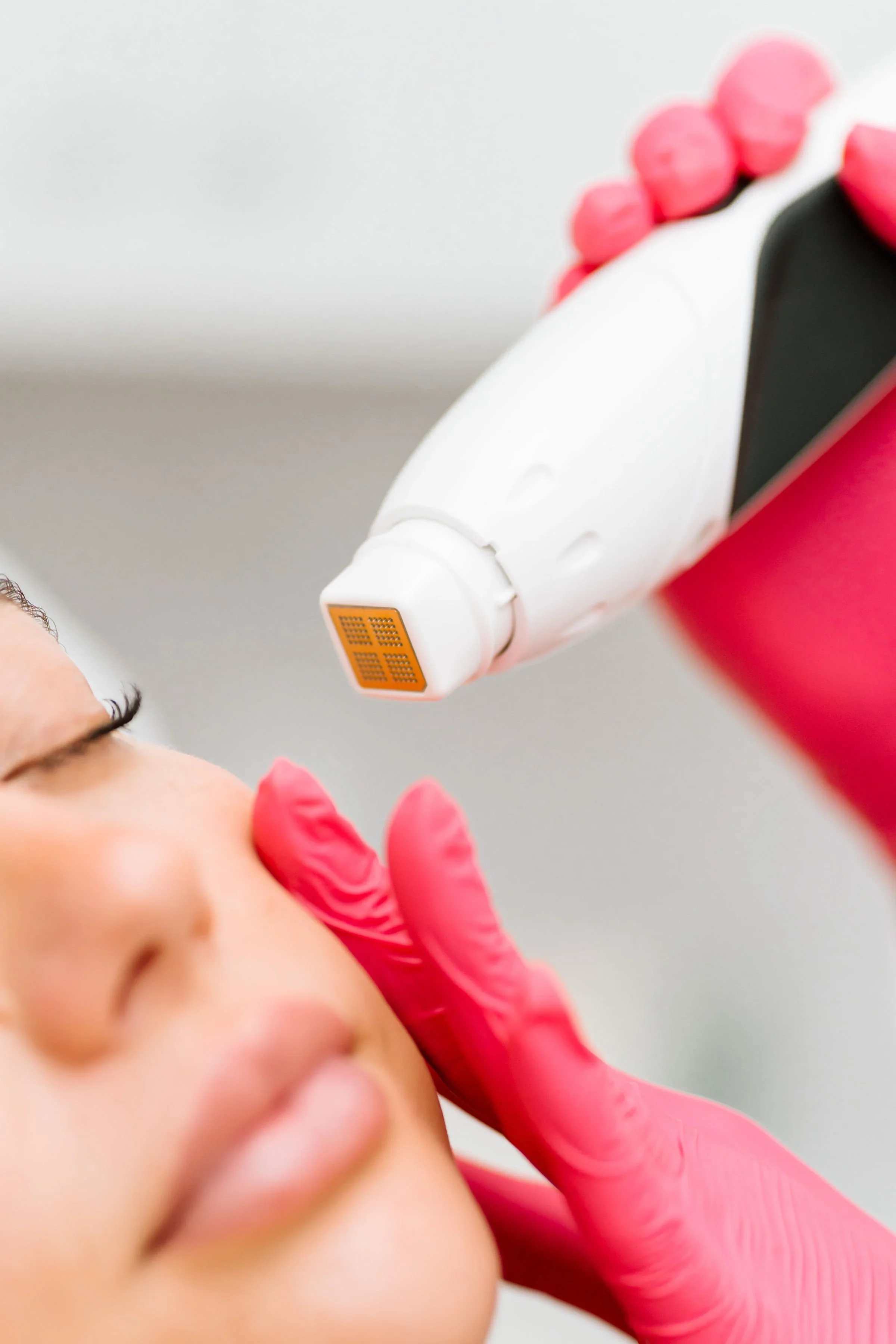 Understanding the Differences Between RF VoluDerm, RF TriFractional, and TriPollar/DMA