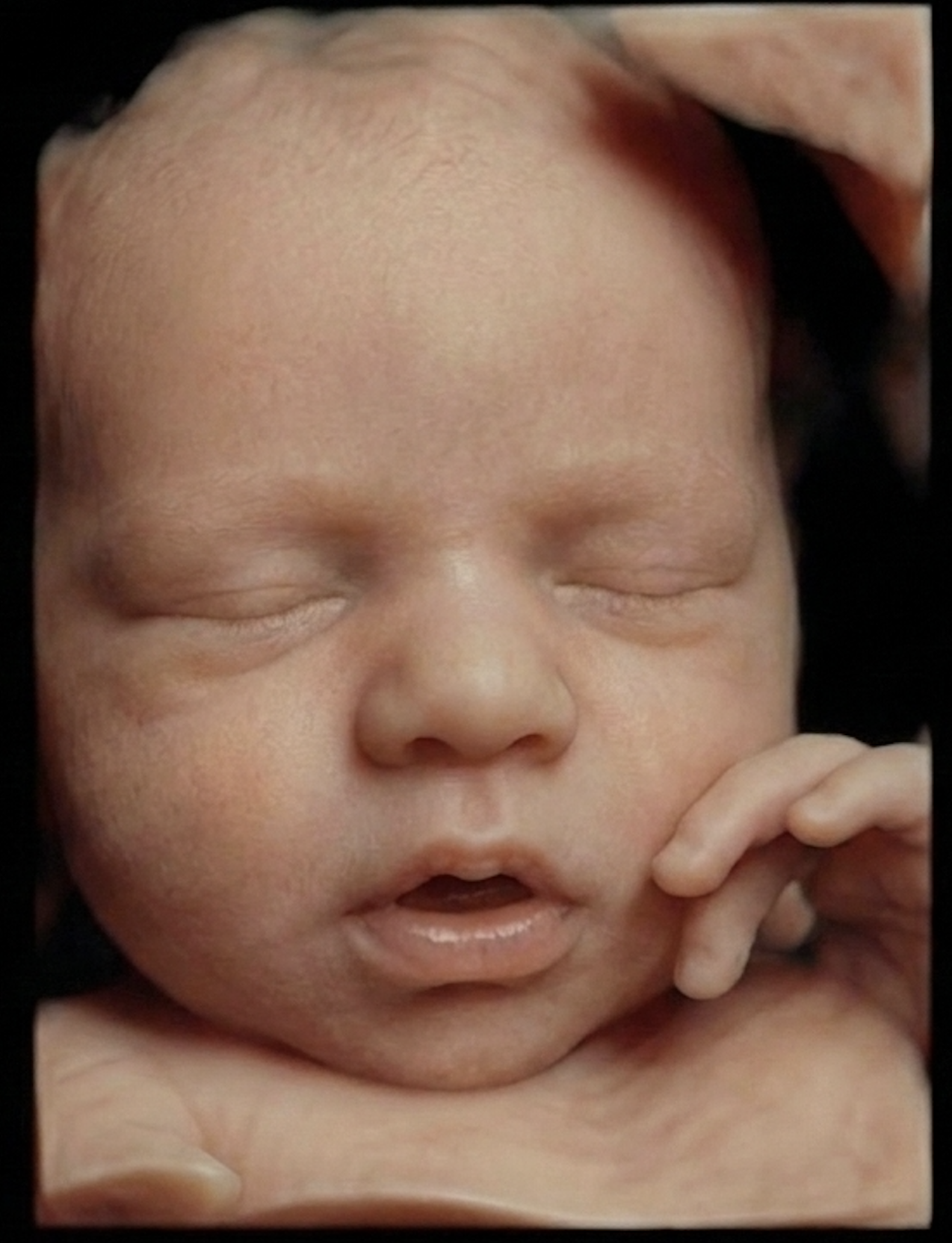 Close-up of a sleeping baby with a peaceful expression, little fingers resting near the mouth.