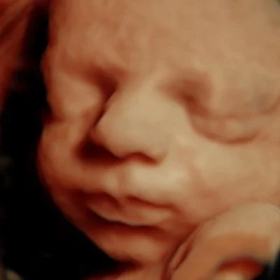 Close-up of a sleeping newborn baby's face.