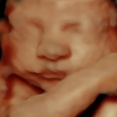 Close-up of a very young baby sleeping, with eyes closed and face resting on a hand.